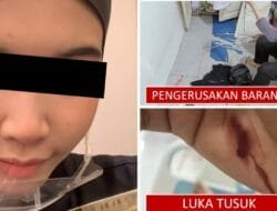 Dugaan Penganiayaan, Seorang Perempuan Dilaporkan ke Polda Sumsel